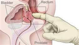 mi a prostatitis amit magában mutat